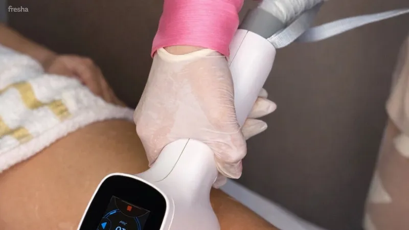 Epilare Definitivă Elysia Beauty Lounge